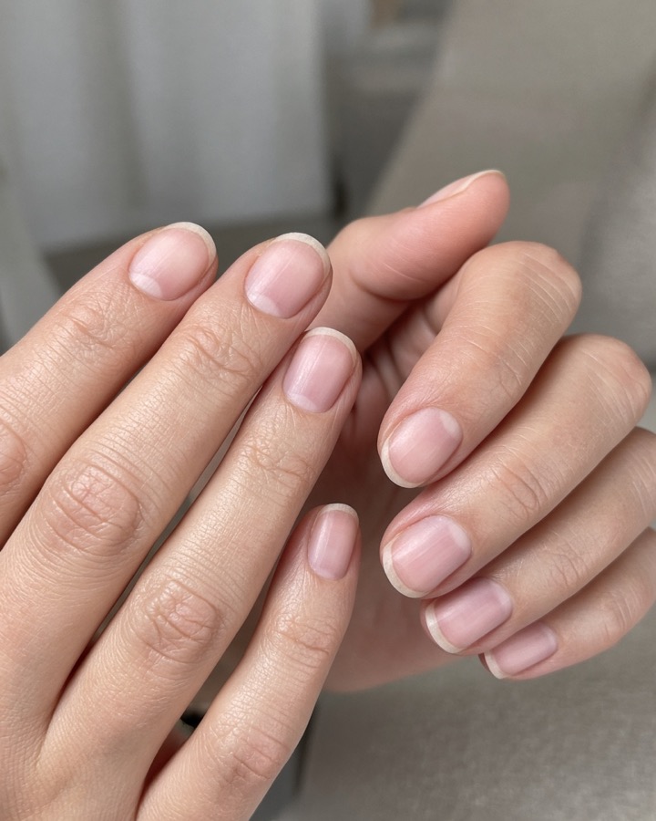 Natural nails